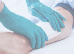 What is an arterial leg ulcer?