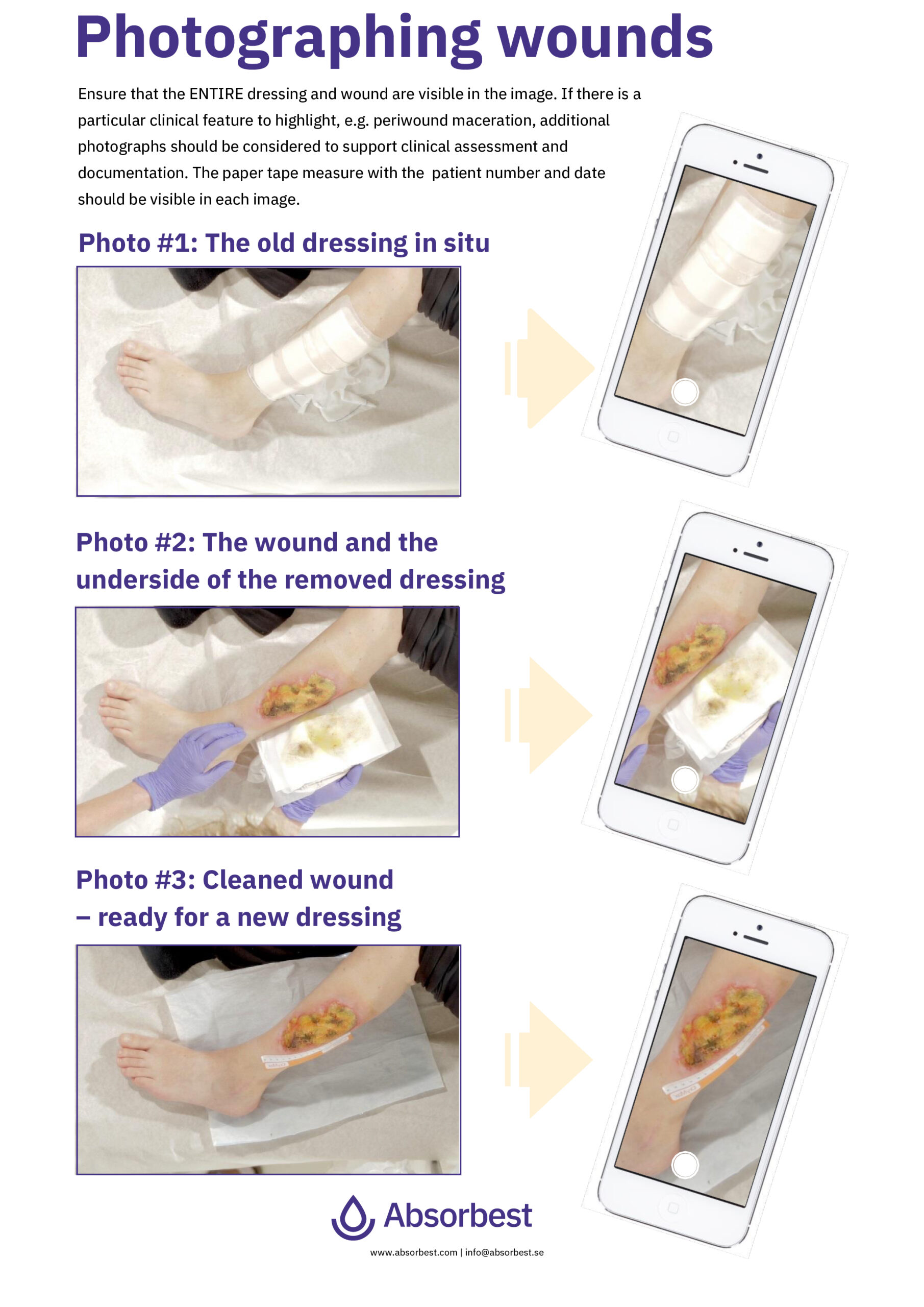 Simple guiding for photo documentation in a wound care process.