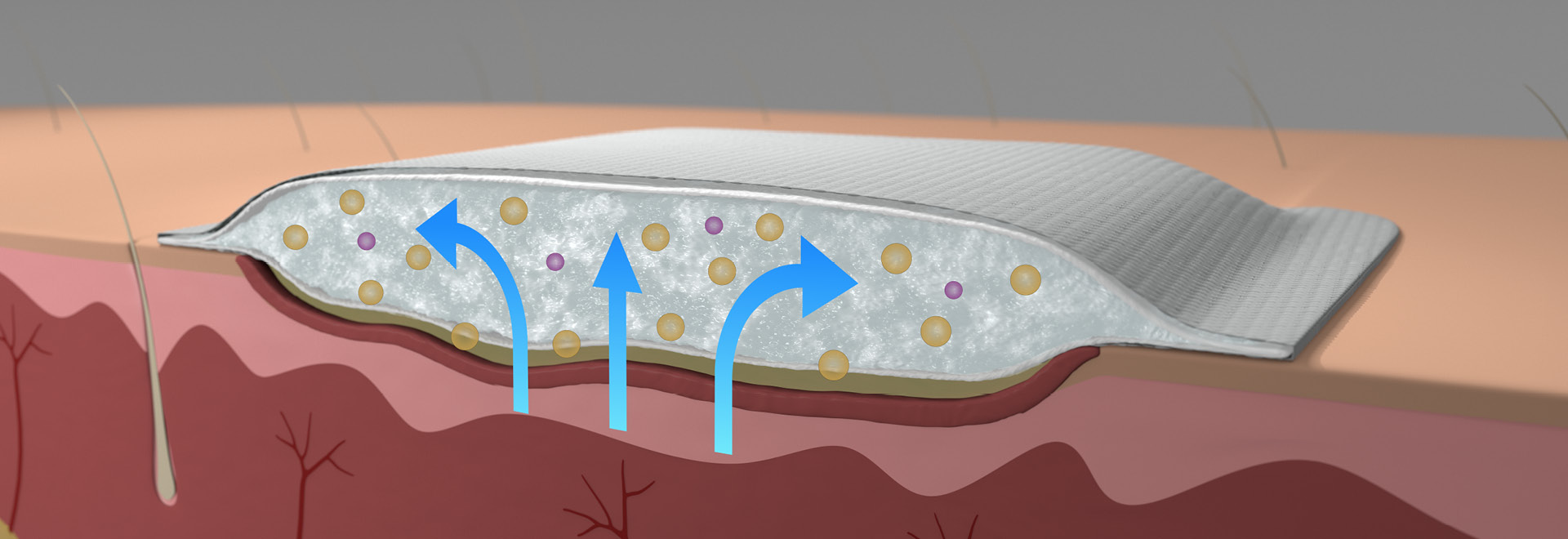 Guiding to venous leg ulcer management and compression therapy