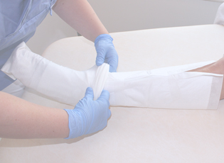 A-large-wound-dressing-for-the-treatment-of-larger-exuding-leg-ulcers