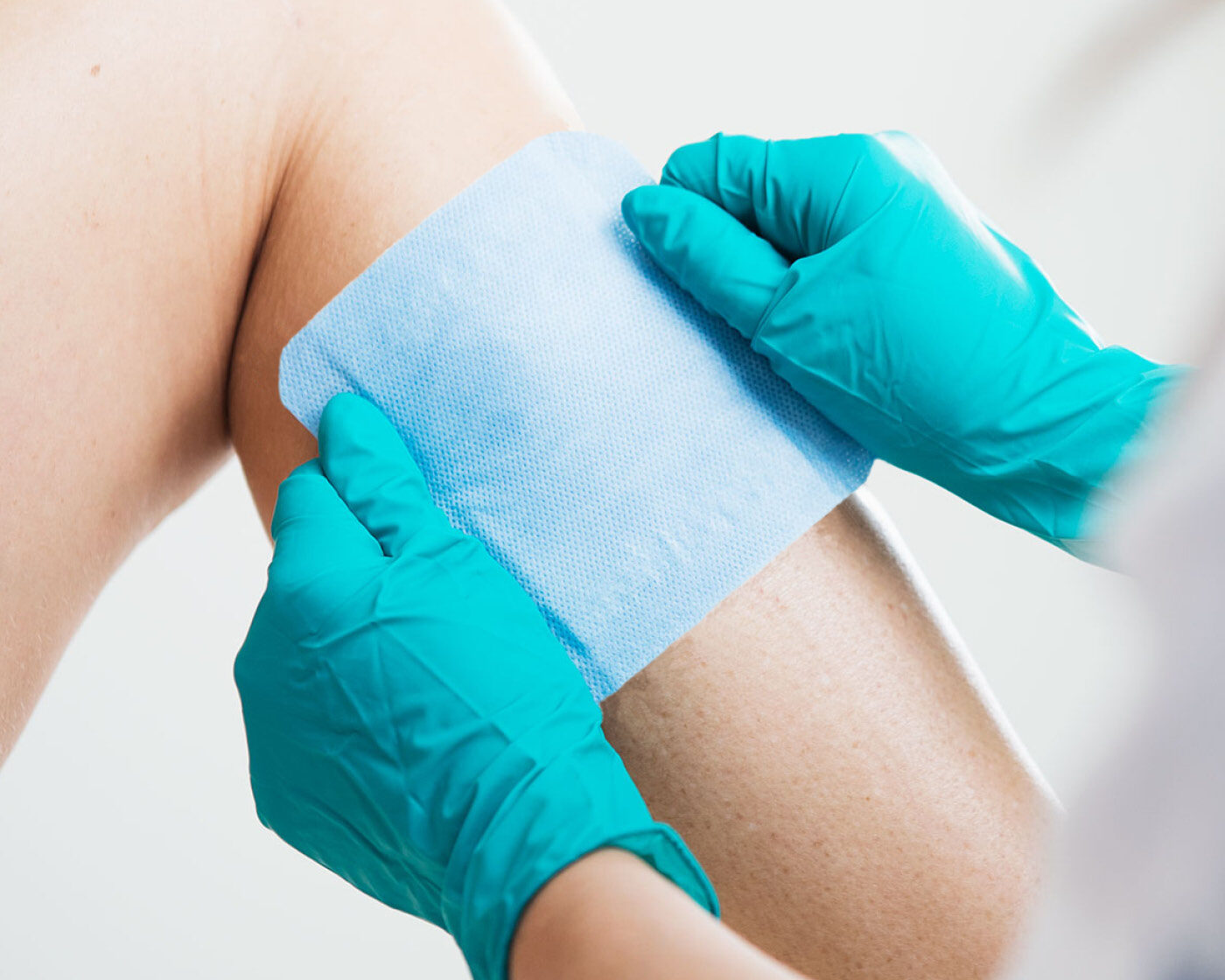 DryMax Blue a superabsorbent dressing for exuding wounds