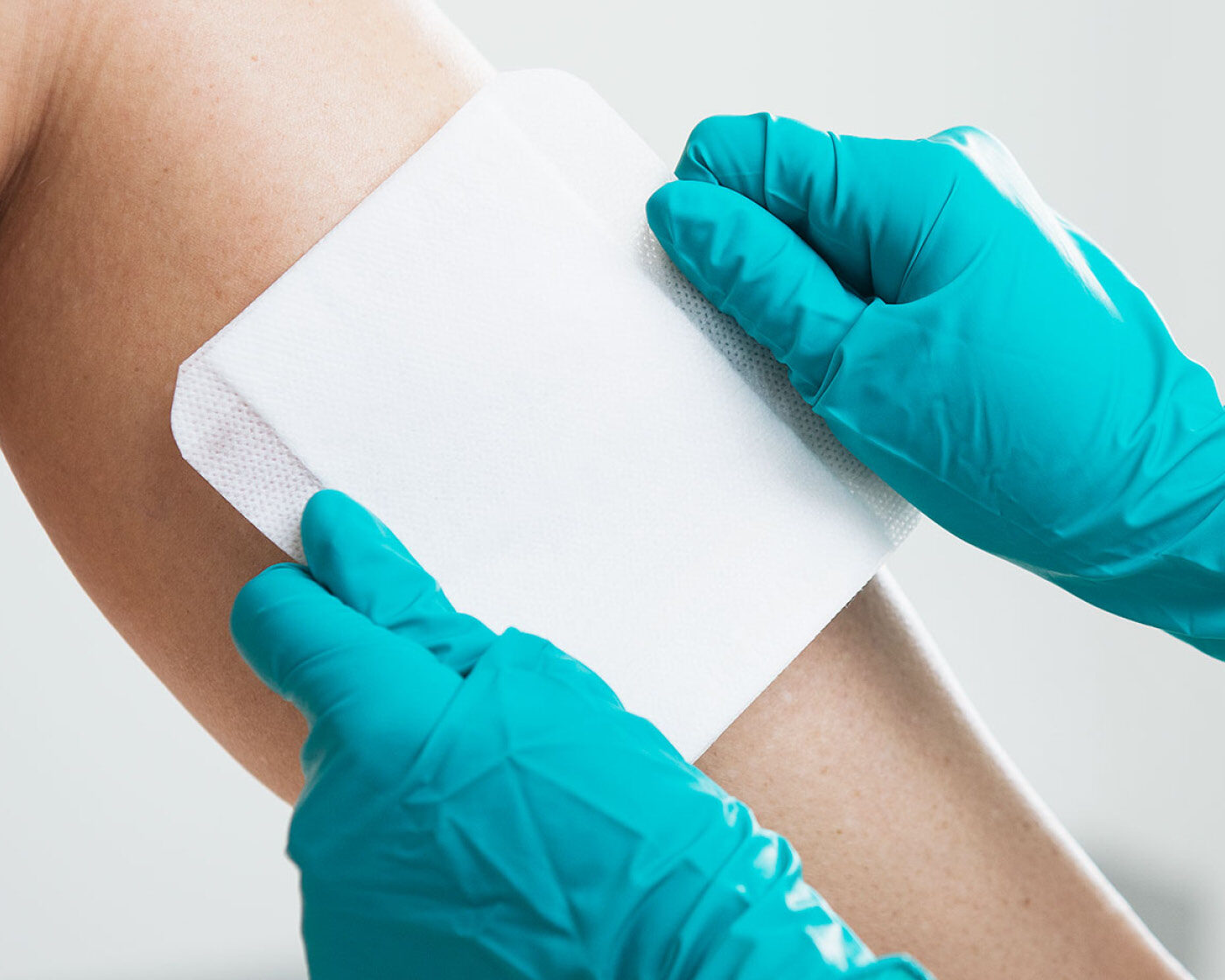 DryMax Super, a sterile superabsorbent wound dressing for compression therapy