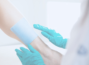 A modern foam dressing with superabsorbent powers is applied to a leg ulcer