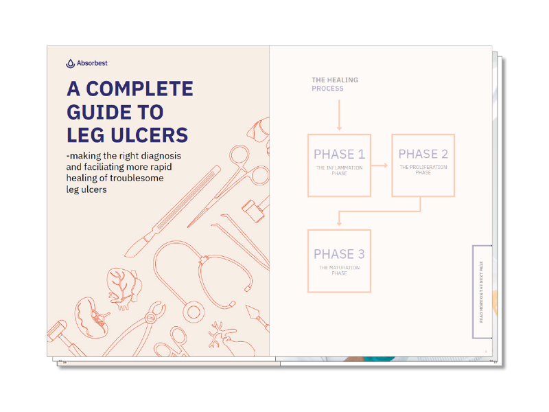 Download guide to venous leg ulcers