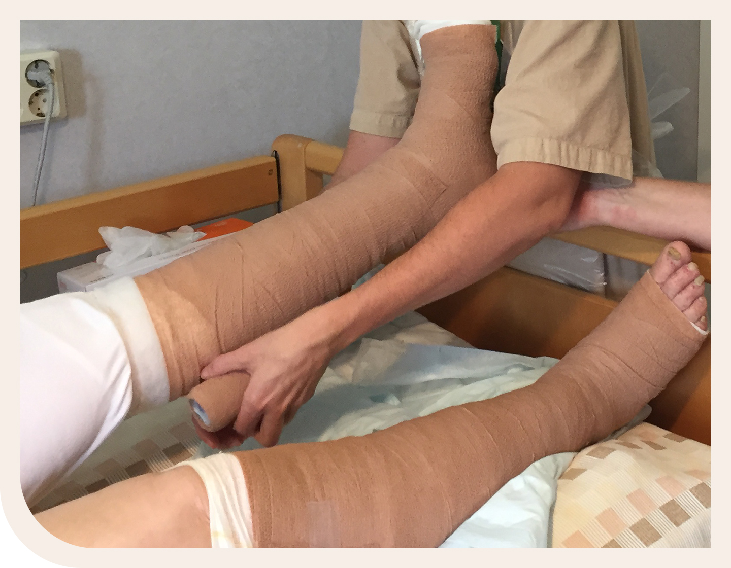 compression therapy on venous leg ulcer