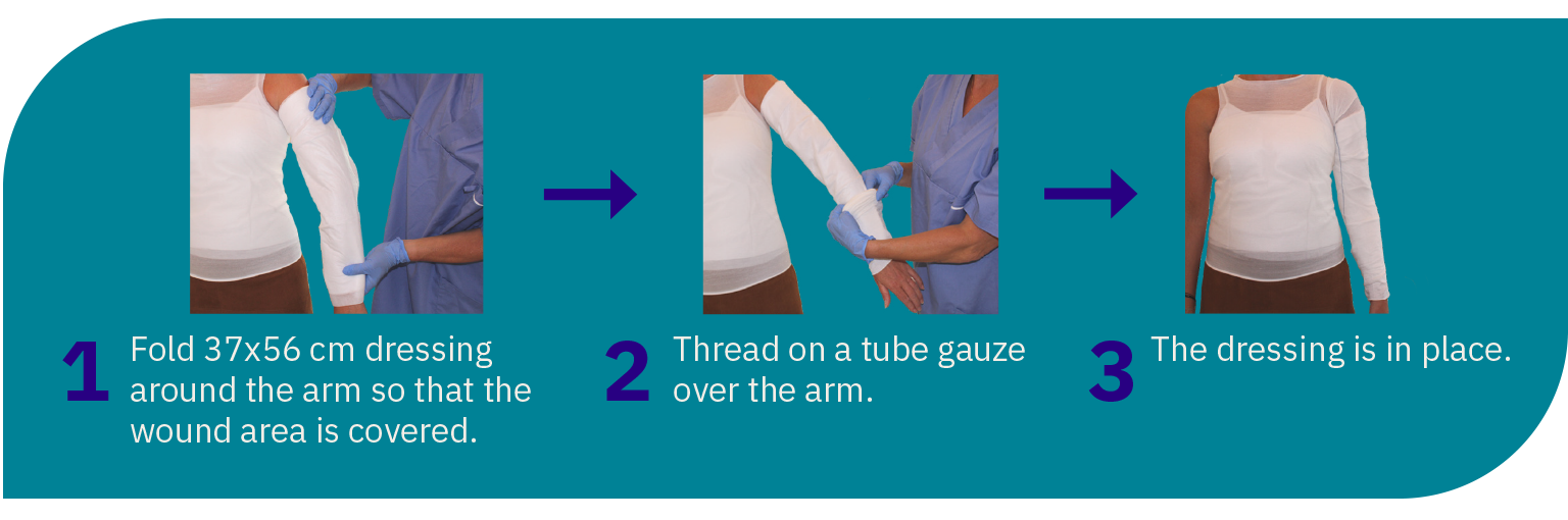 A folding guide for wound dressings Wound management