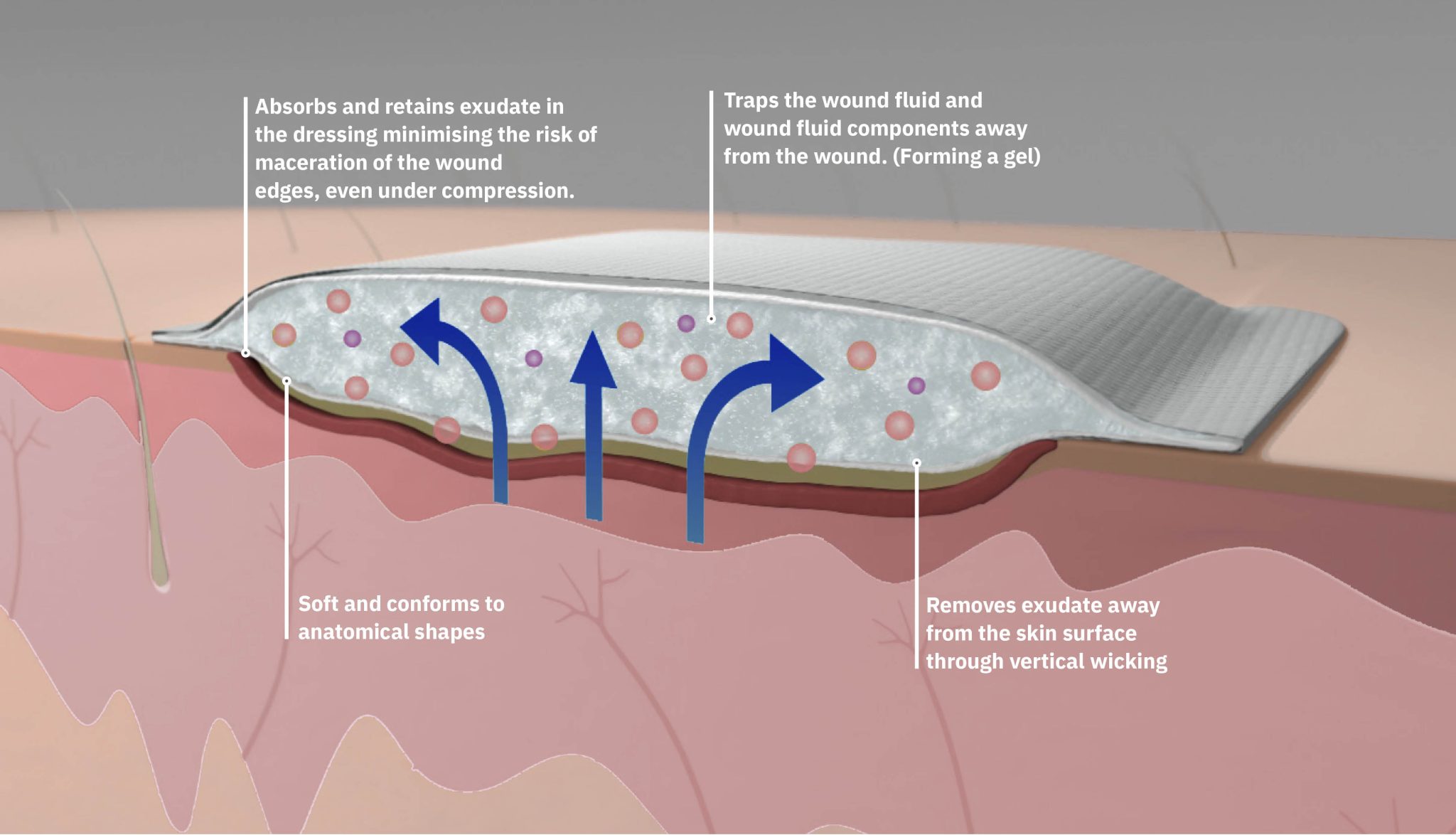 How to Choose the Right Wound Dressing | Clinical Advice
