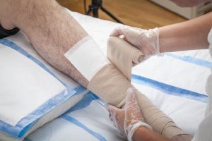 wound management with a superabsorbent dressing, DryMax Super from Absorbest